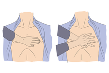 Position der Hände bei der Herzdruckmassage
