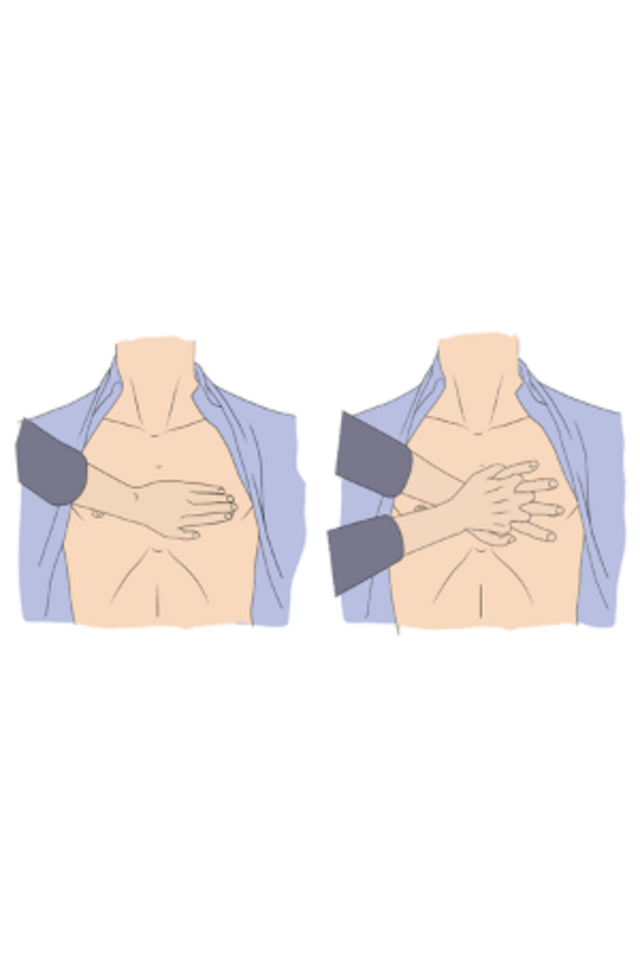 Position der Hände bei der Herzdruckmassage