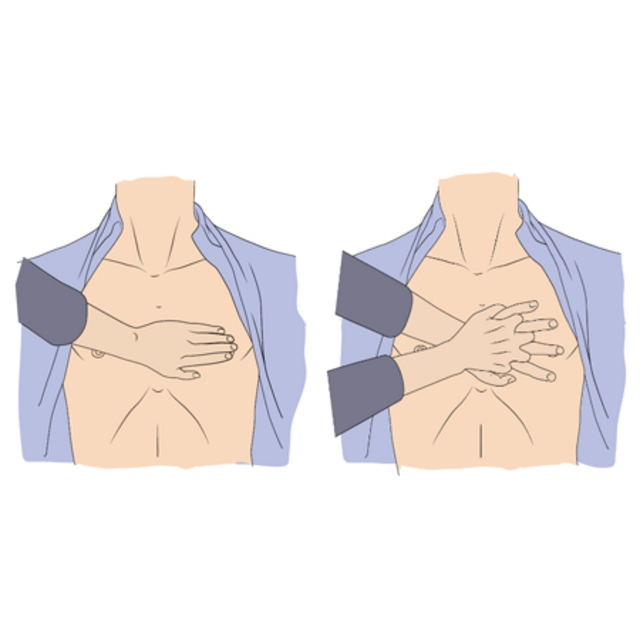 Position der Hände bei der Herzdruckmassage